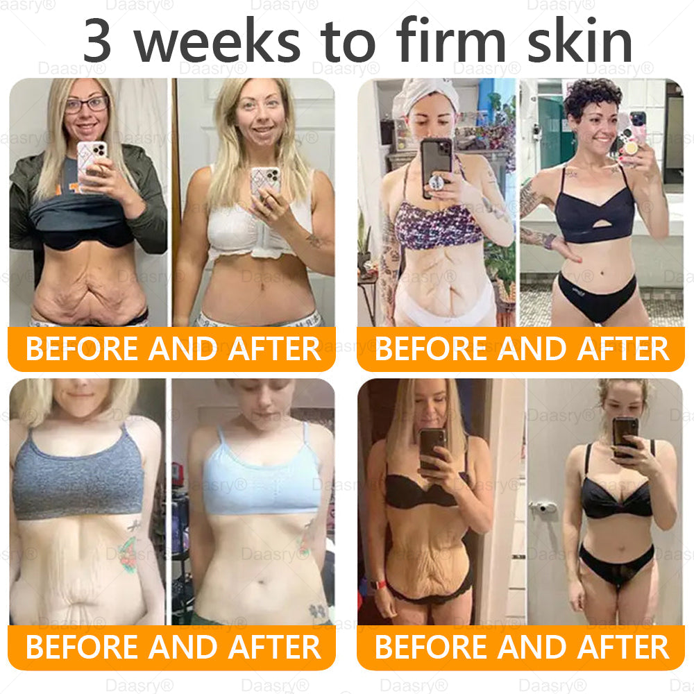 Daasry® Bee Venom Treatment Cream🍁 Targets wrinkles, purpura, sagging, stretch marks, dark spots, warts and more