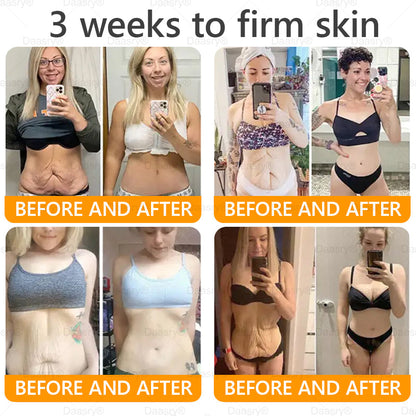 Daasry® Bee Venom Treatment Cream🍁 Targets wrinkles, purpura, sagging, stretch marks, dark spots, warts and more