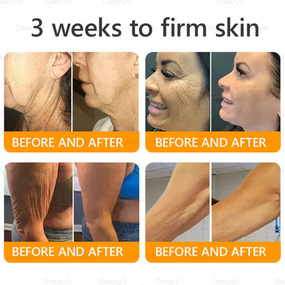 Daasry® Bee Venom Treatment Cream🍁 Targets wrinkles, purpura, sagging, stretch marks, dark spots, warts and more